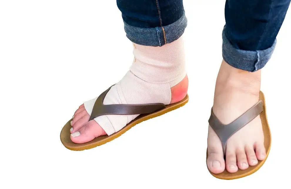 best sandals for Achilles tendonitis
