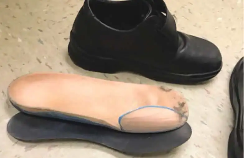 shoes for big toe amputees